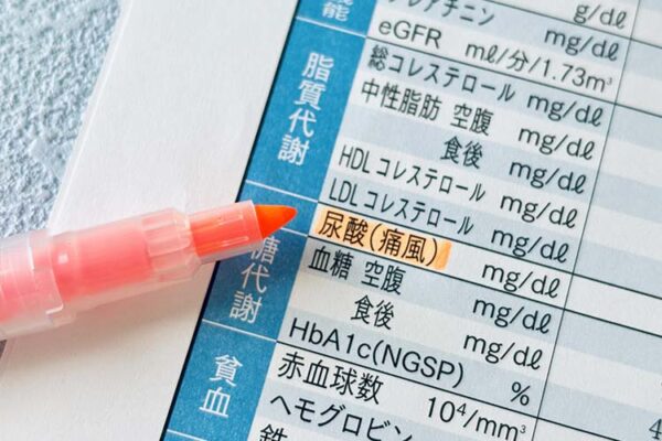 尿酸値が気になる方へ｜食事で見直したい食べ物と食事のポイント